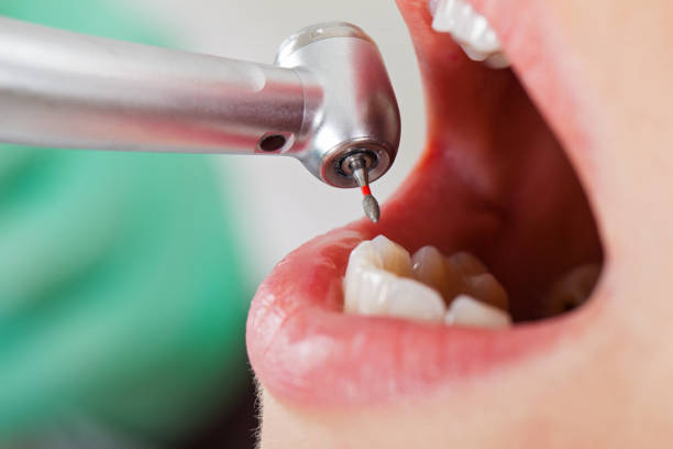 Best Tooth Infection Emergency Dentist  in Mount Ivy, NY